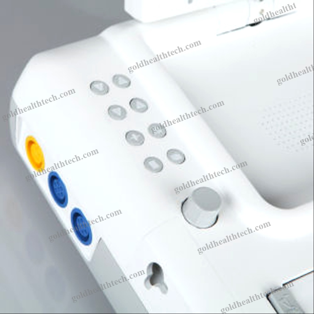 Fetal Monitor