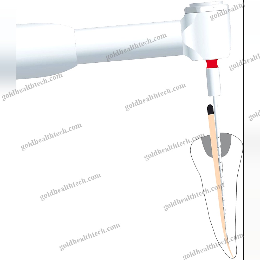 Gutta-Percha Root Canal Obturator