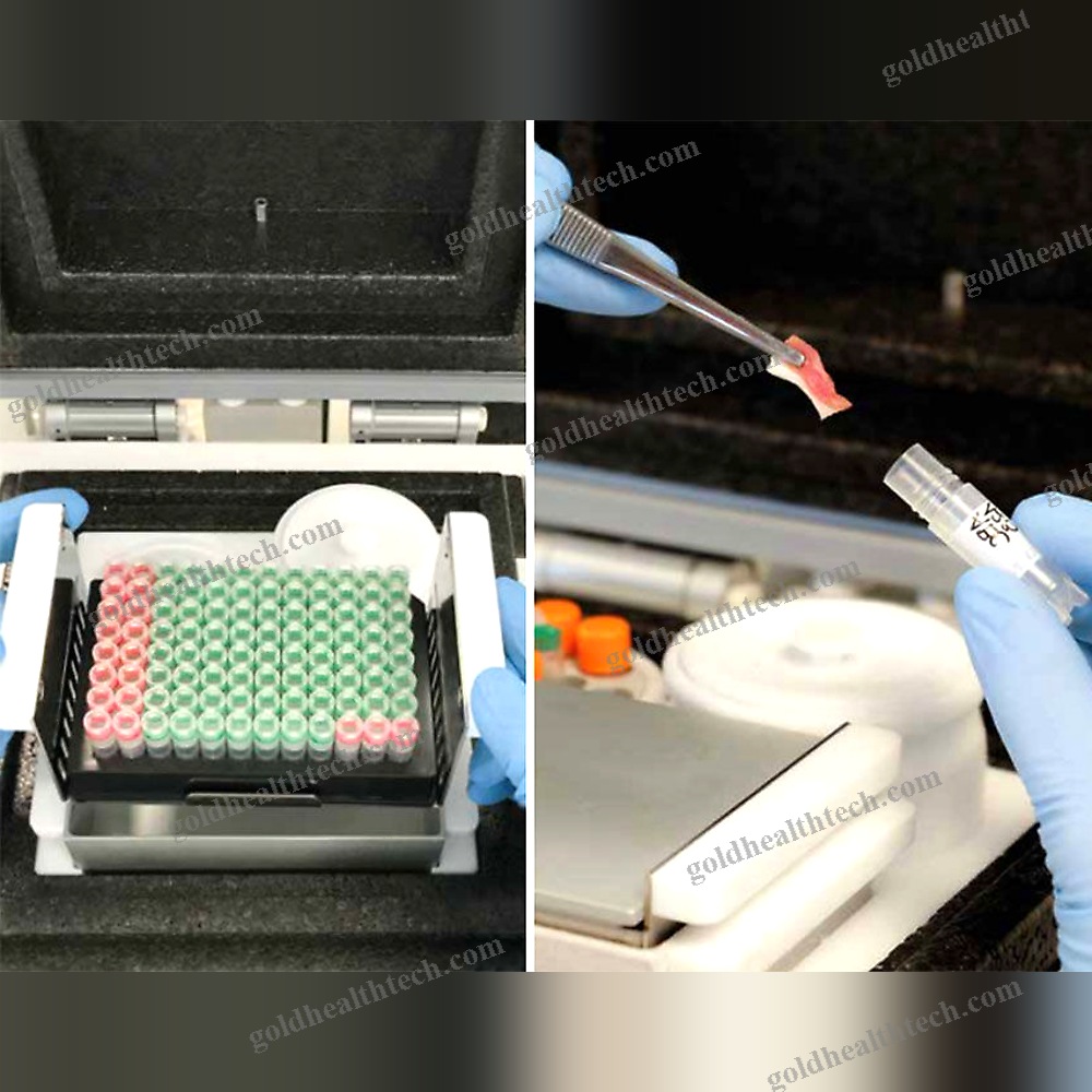 Biobank Freezer