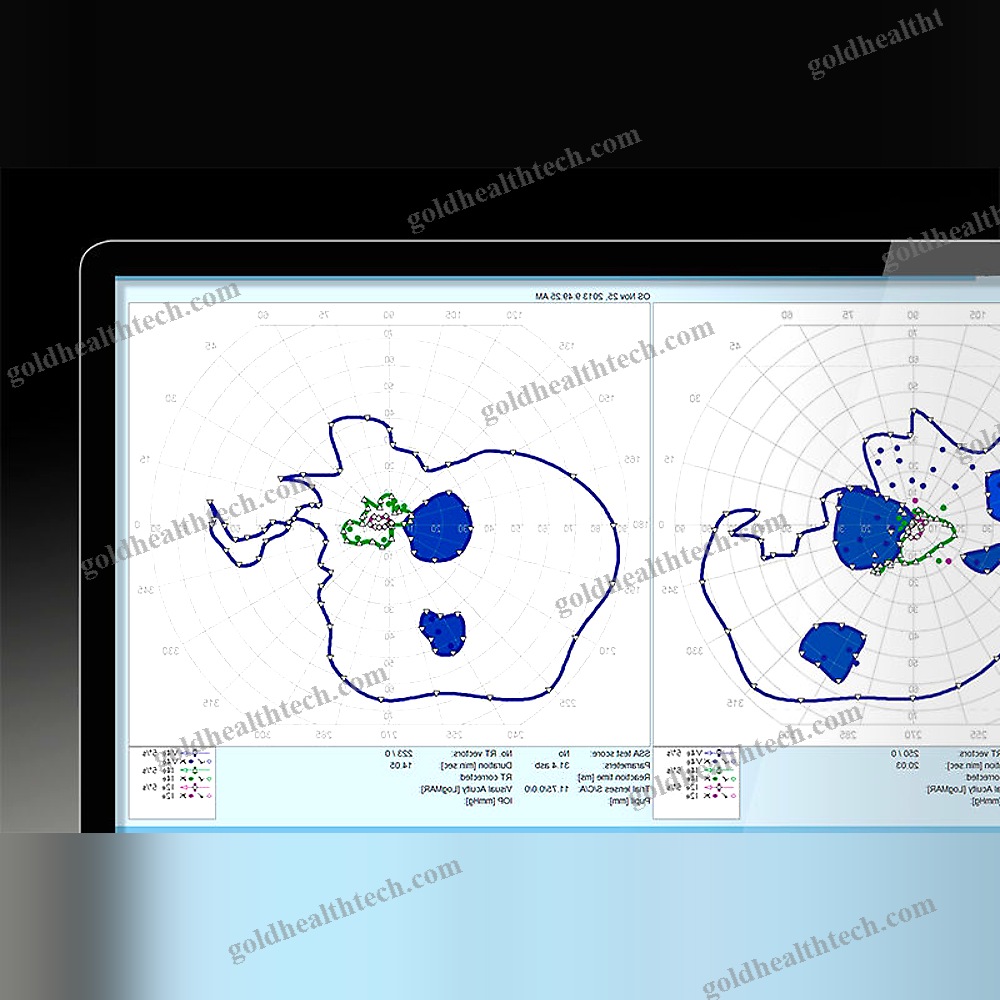 Ophthalmic Perimeter