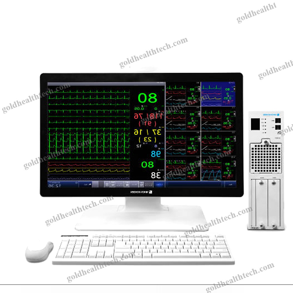 Central Patient Monitoring Station