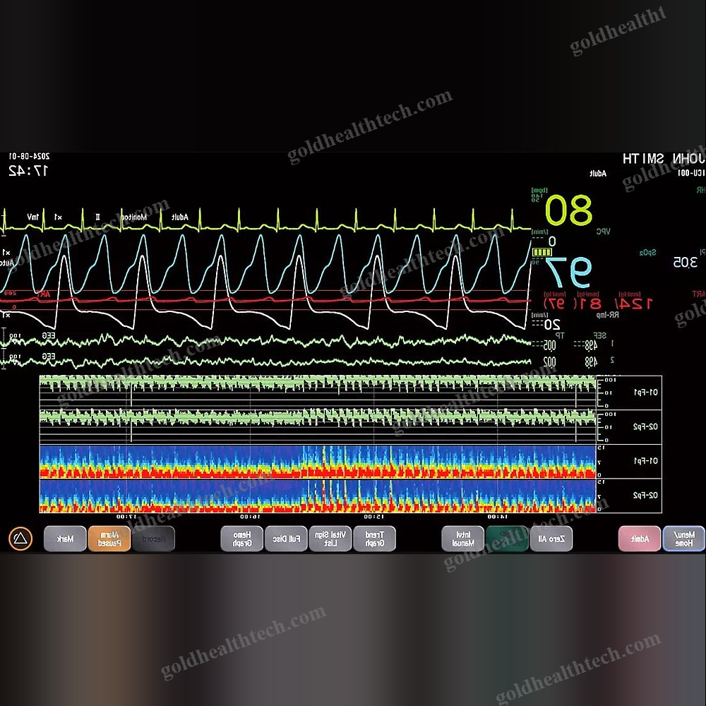 Portable Multi-Parameter Monitor