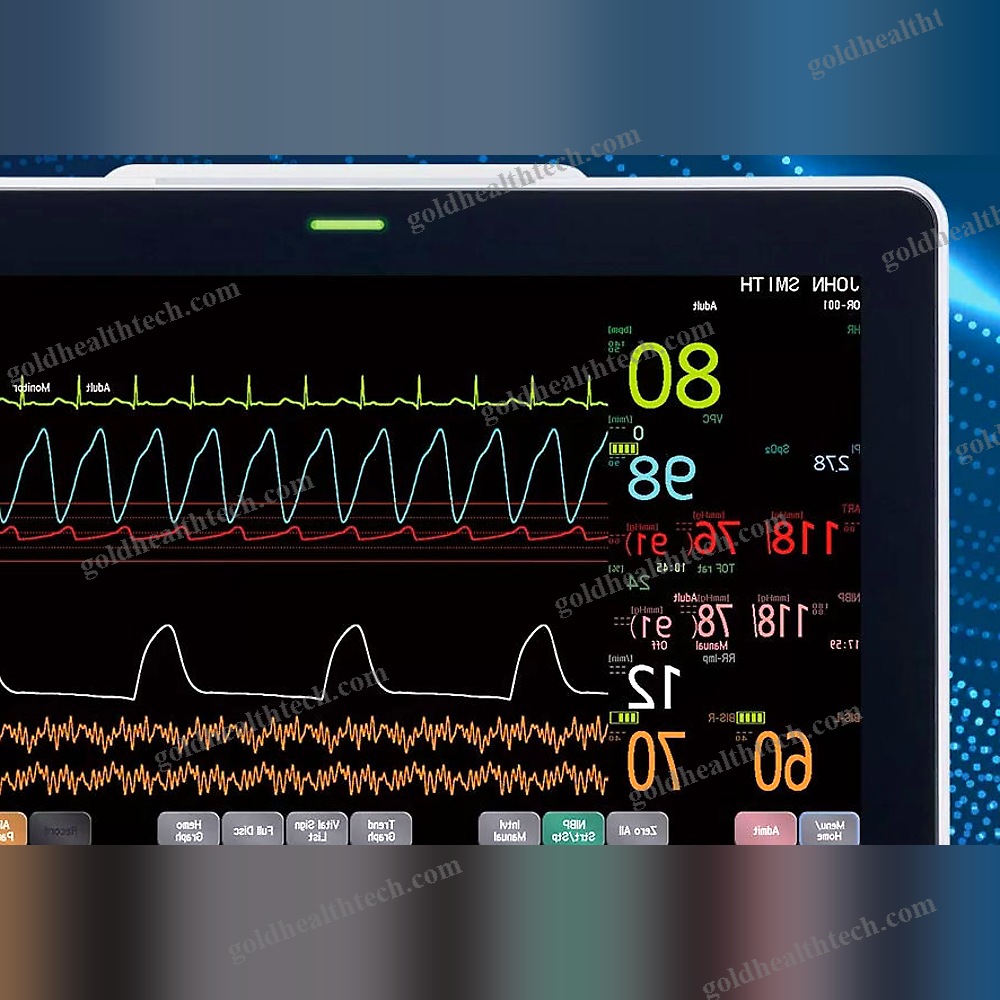 Portable Multi-Parameter Monitor