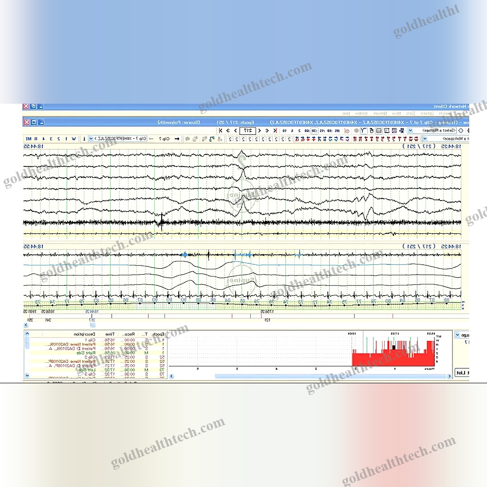 32-Channel Eeg System