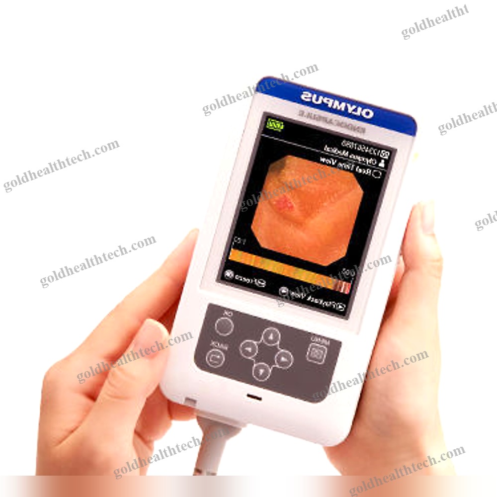 Digestive Endoscopy Capsule
