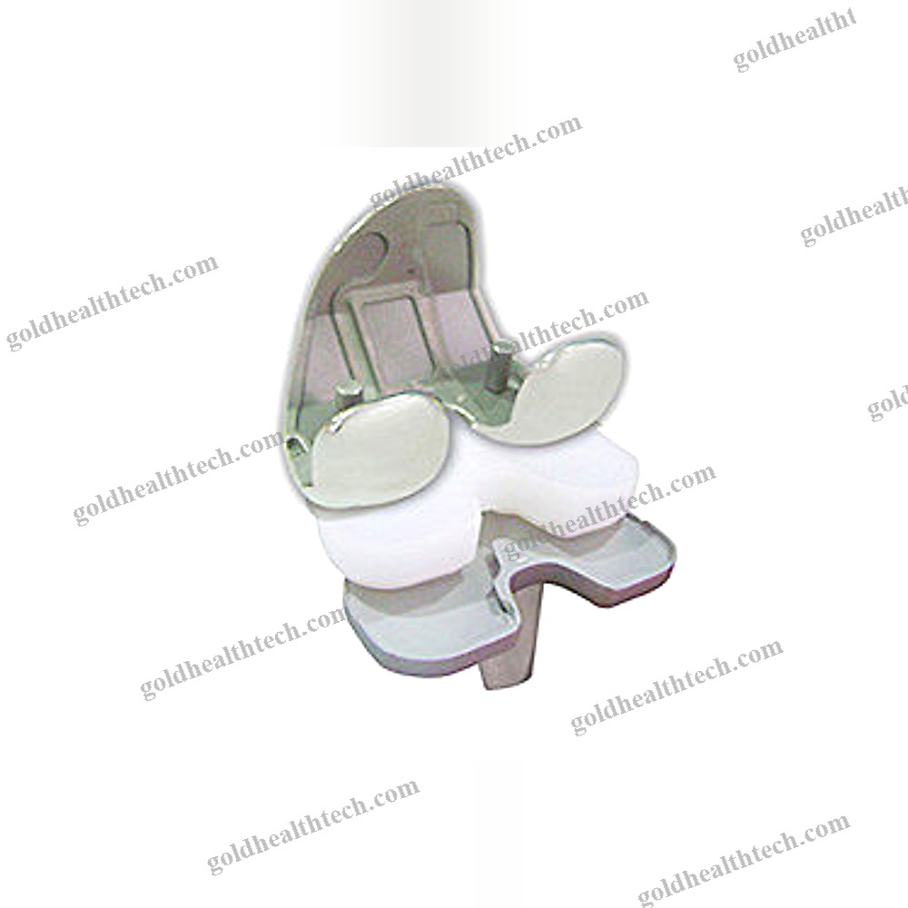 Total Knee Prosthesis