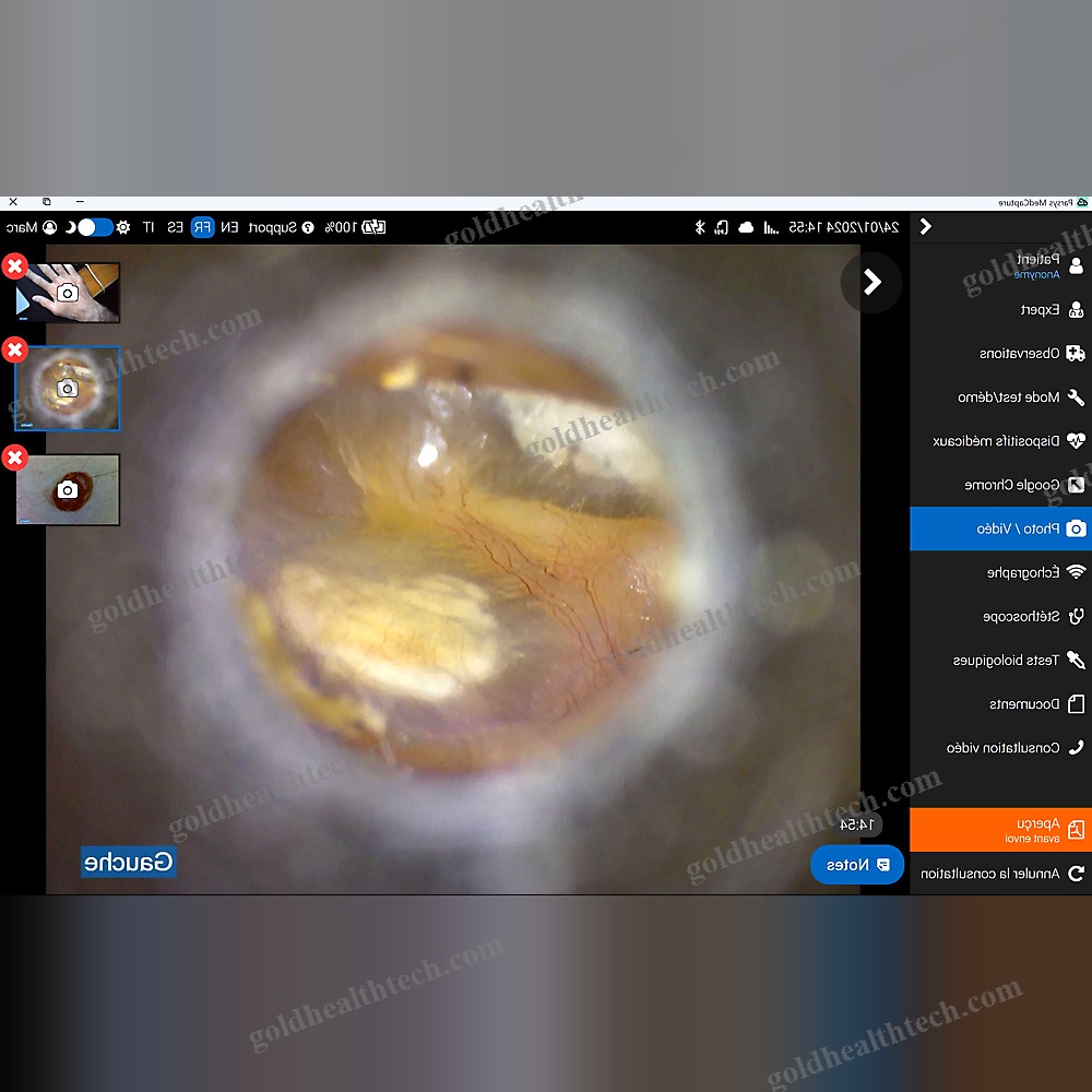 Telemedicine Software