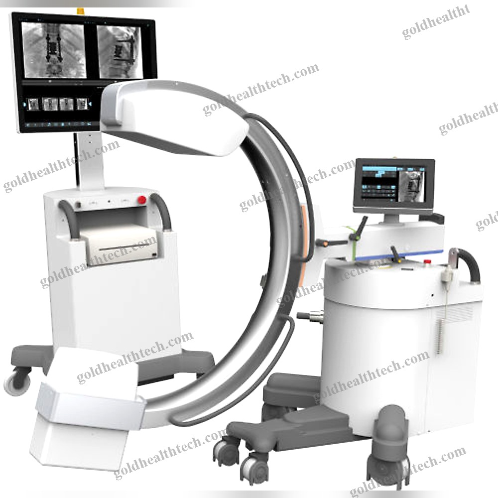 Mobile C-Arm
