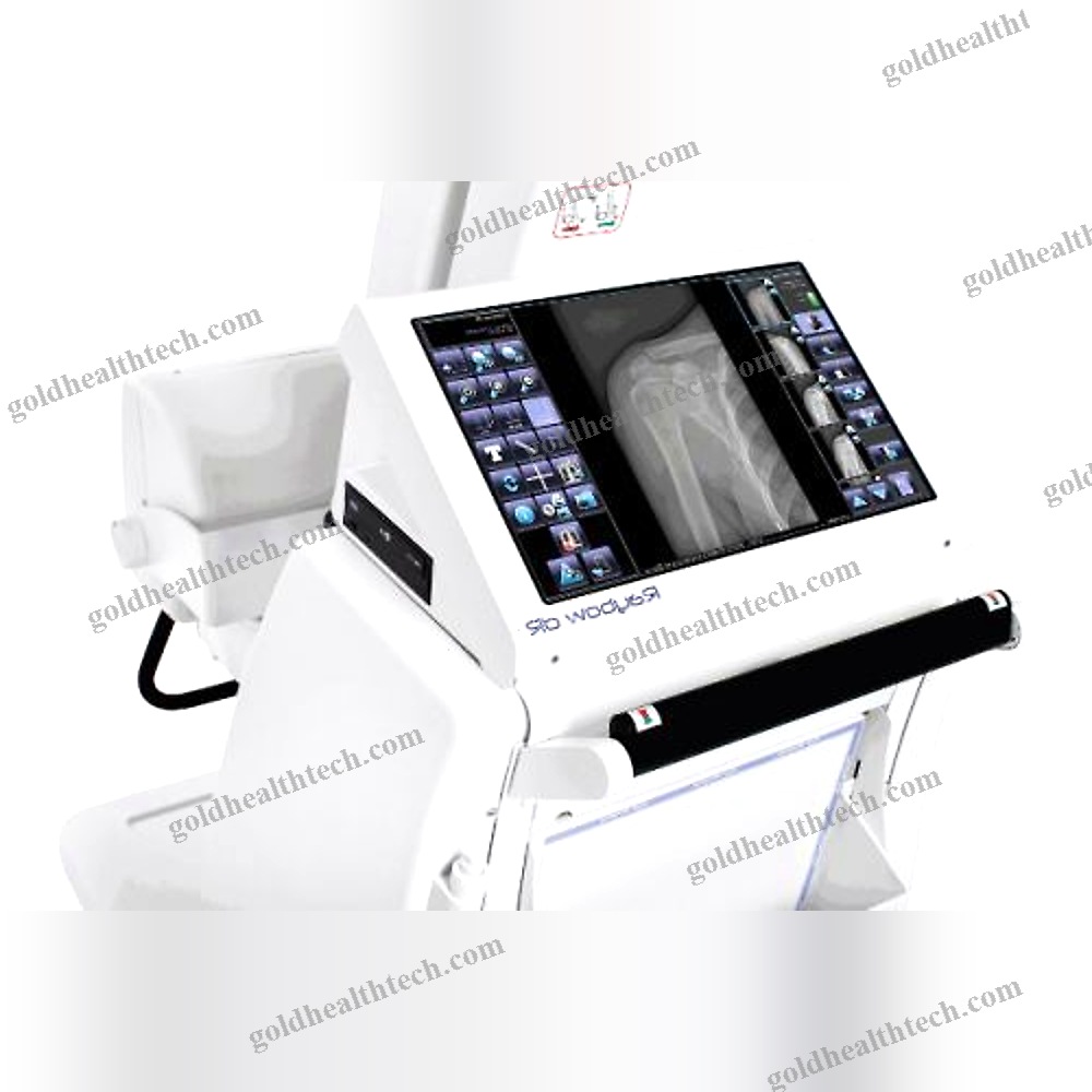 Digital Mobile Radiography Unit