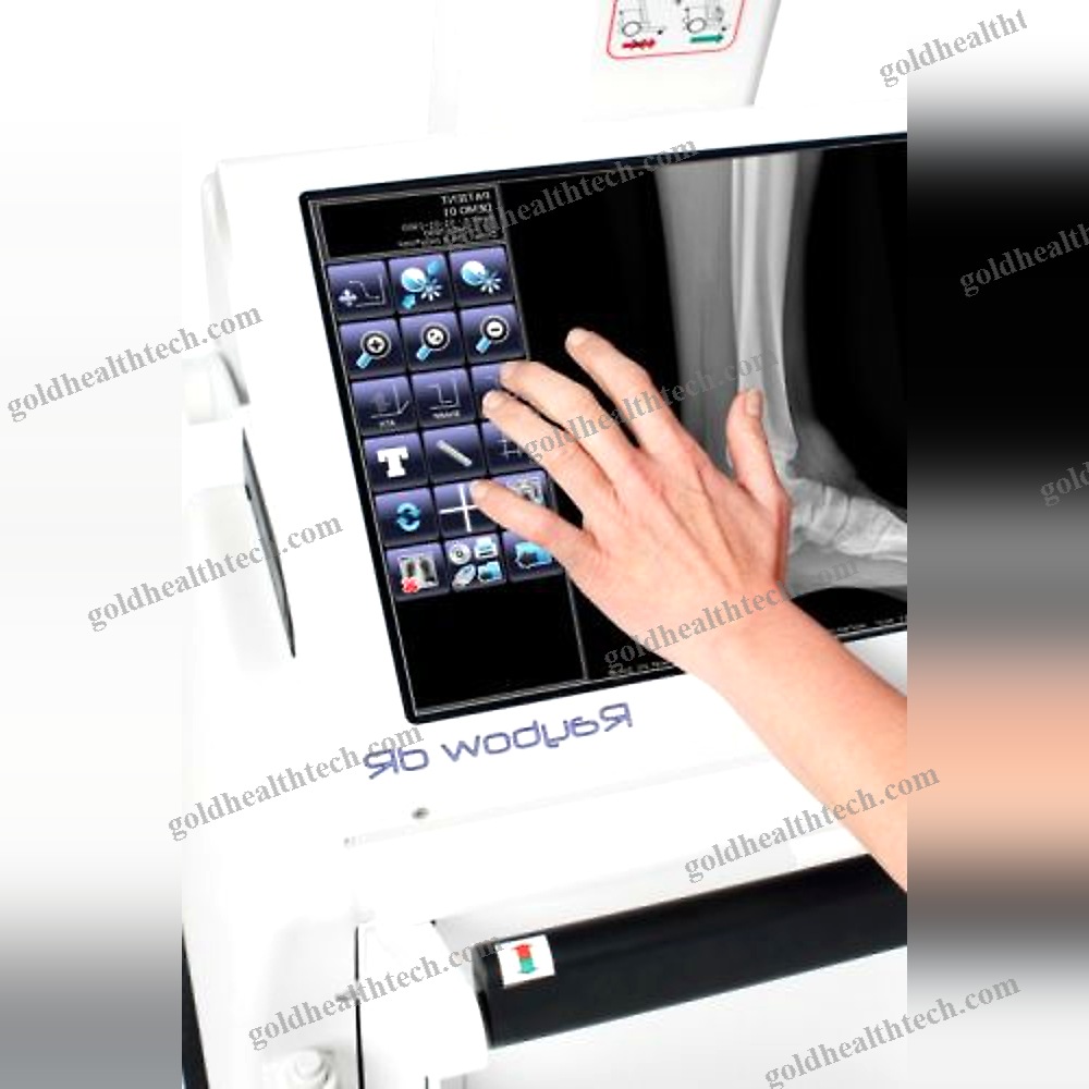 Digital Mobile Radiography Unit