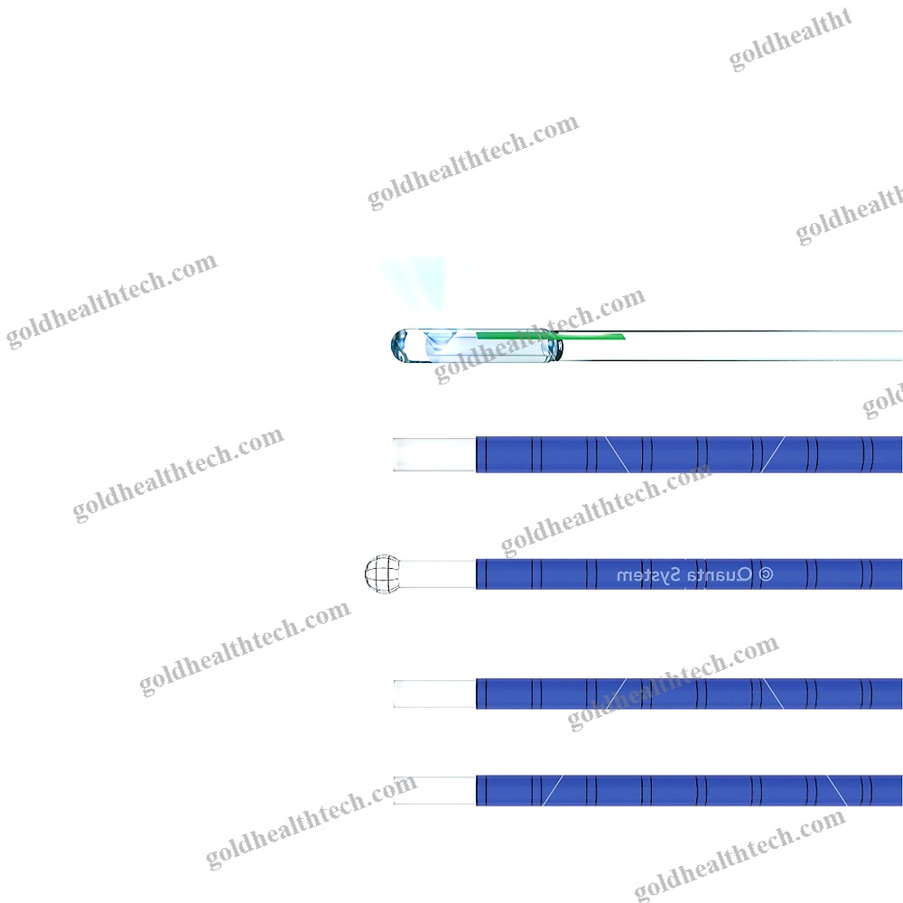Lithotripsy Laser