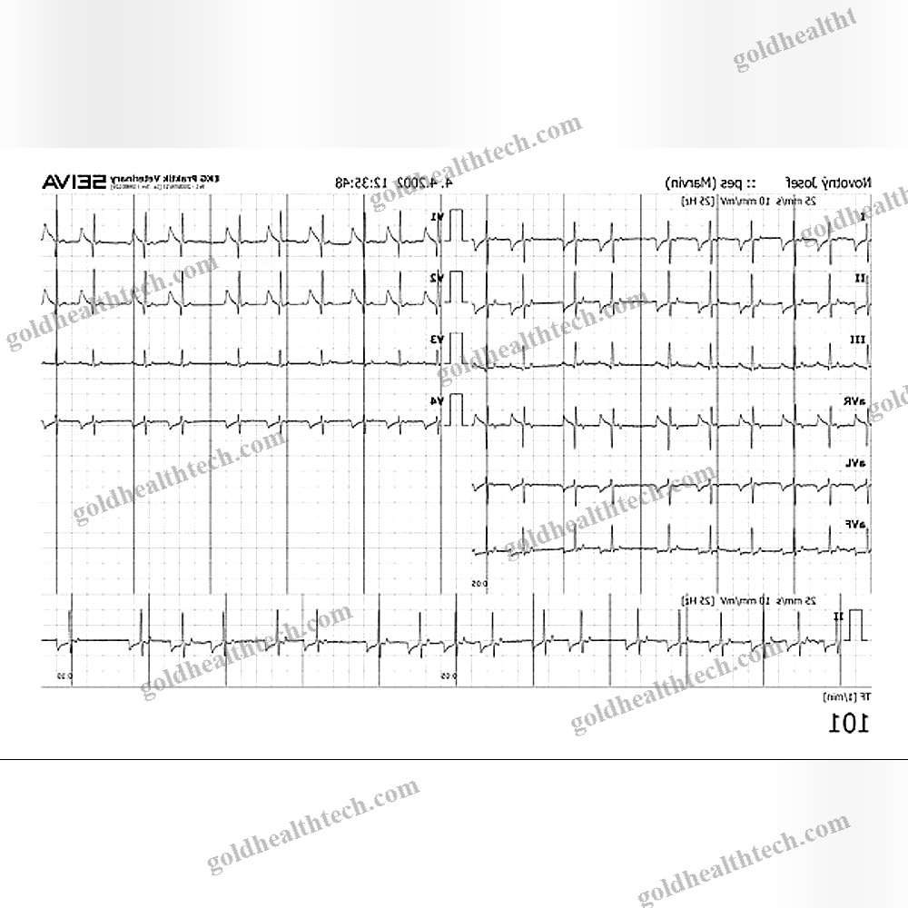 12-Channel Veterinary Ecg System