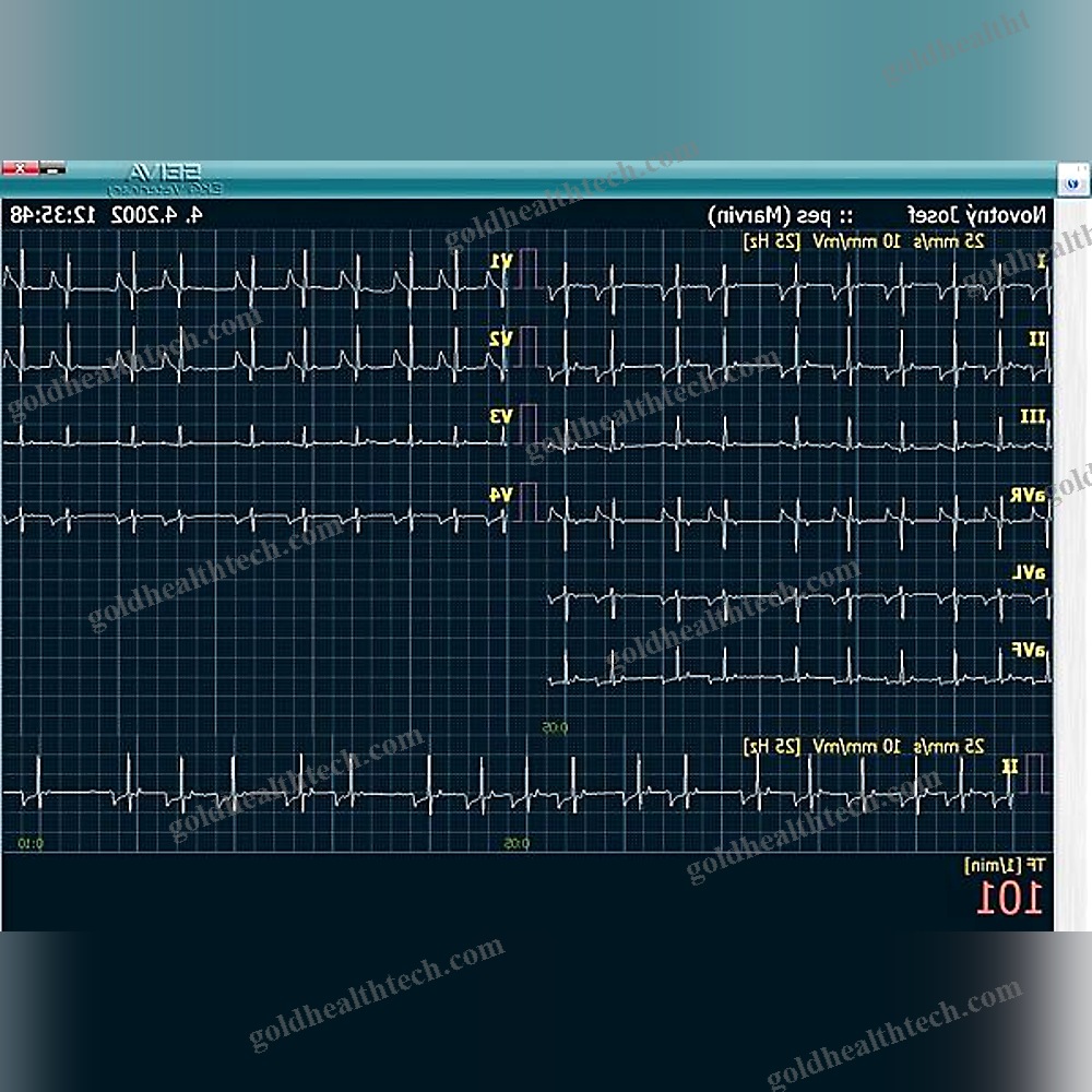 12-Channel Veterinary Ecg System