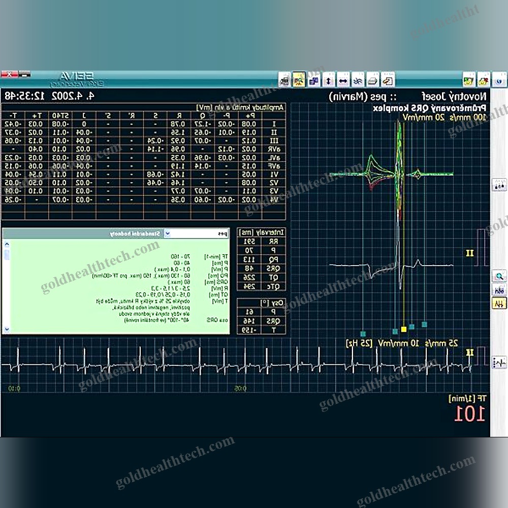 12-Channel Veterinary Ecg System