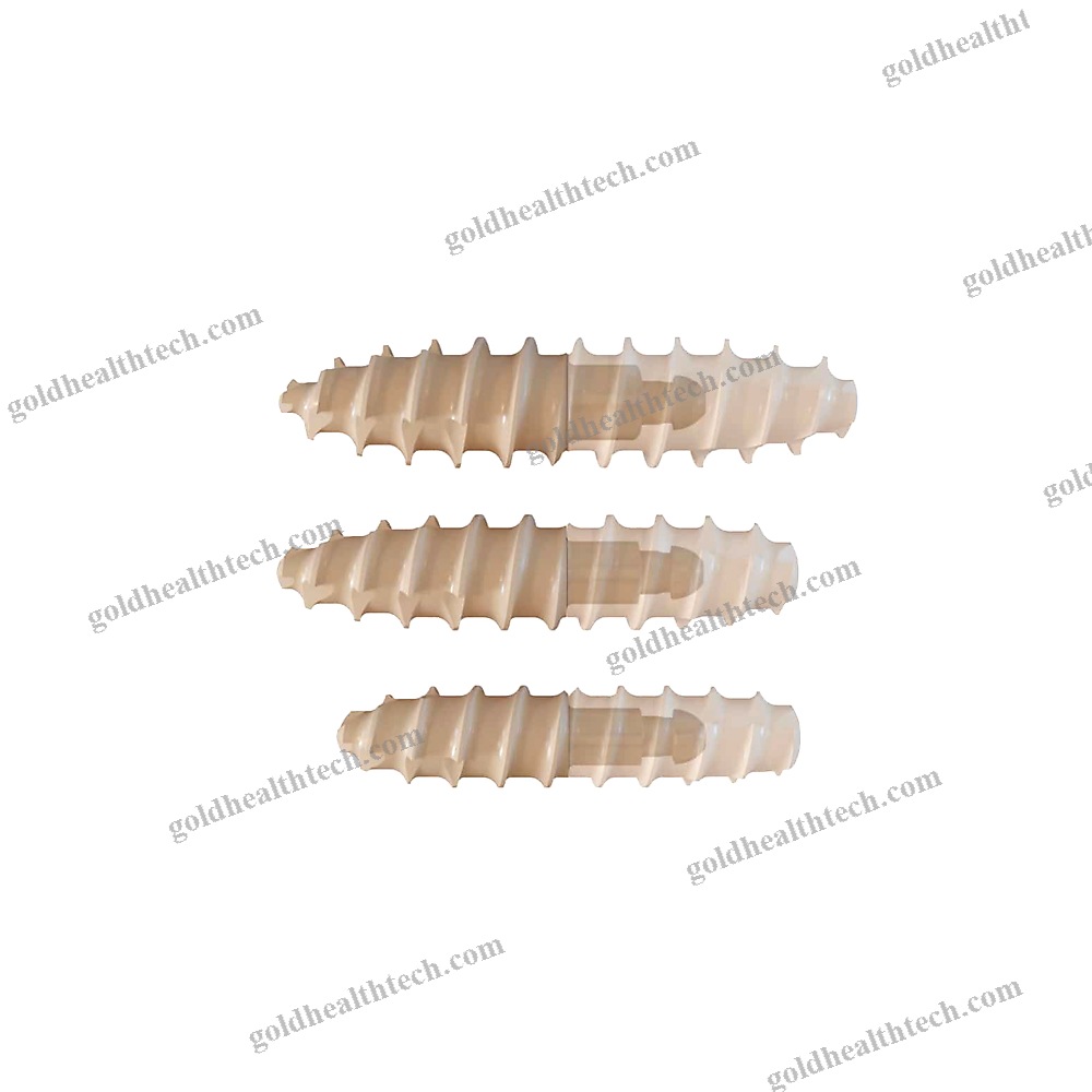 Interphalangeal Foot Joint Arthrodesis Screw