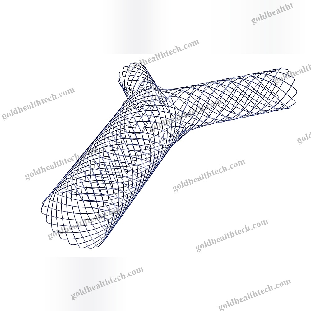 Bronchial Stent