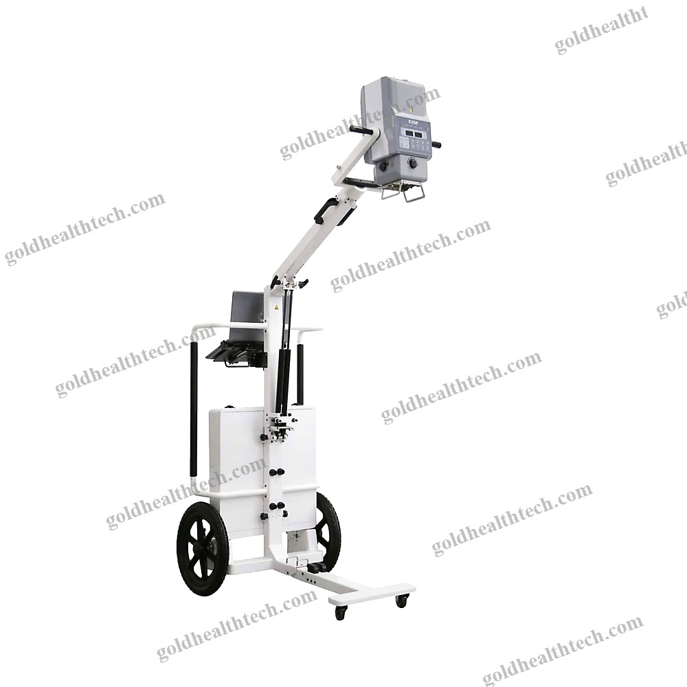 Portable Radiography System