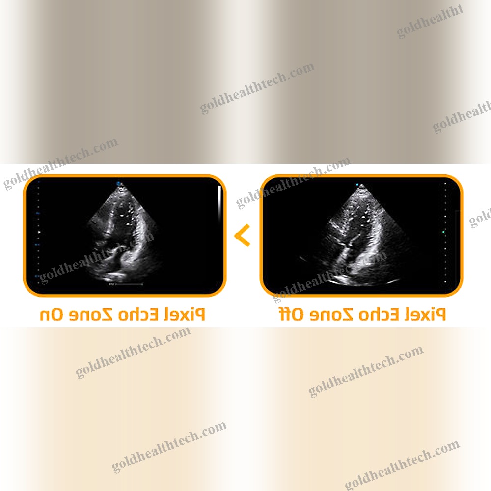 Multipurpose Veterinary Ultrasound System