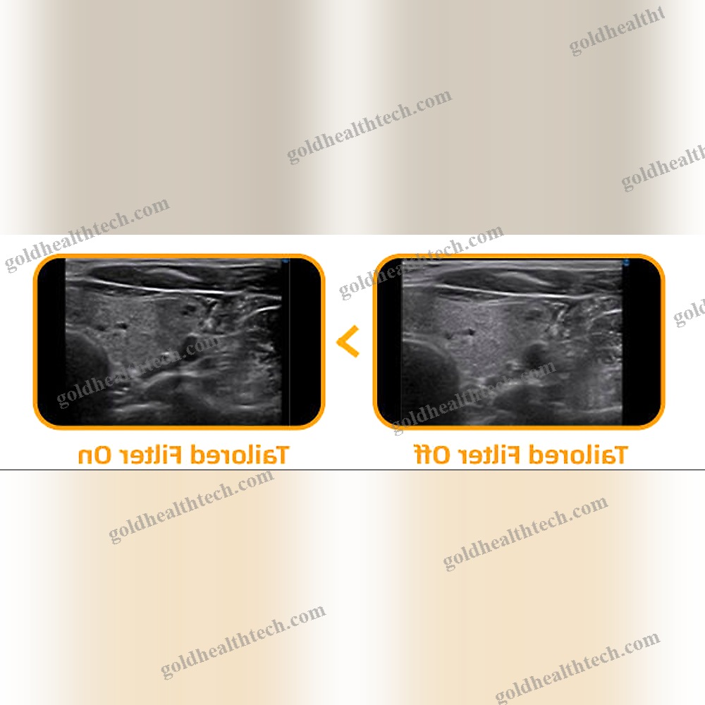Multipurpose Veterinary Ultrasound System