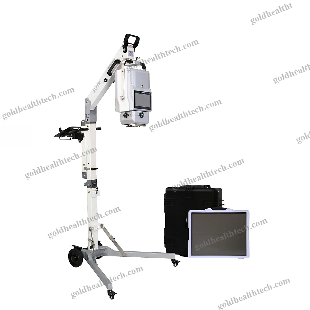 Portable Radiography System