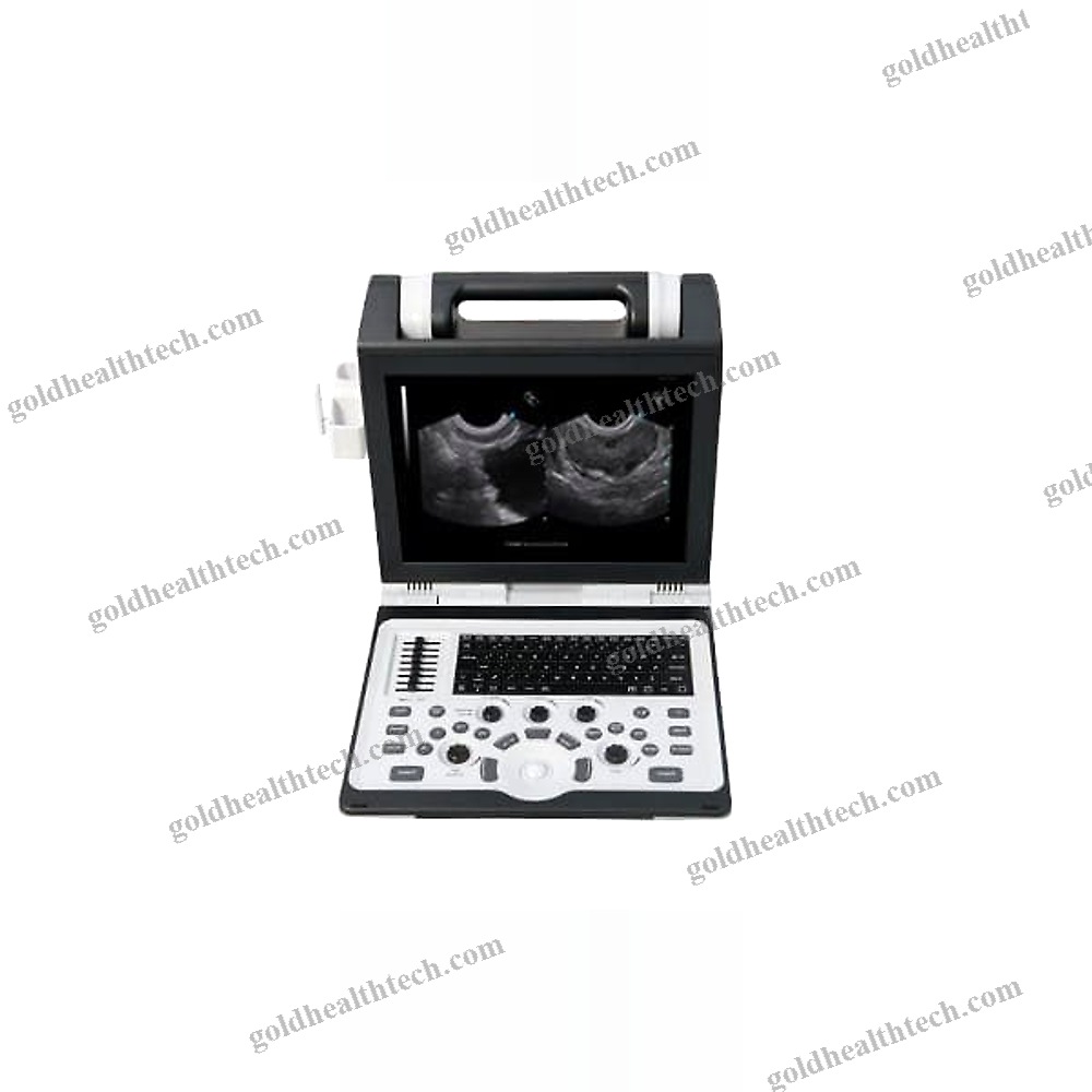 Portable Ultrasound System