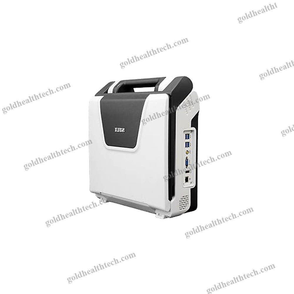 Portable Ultrasound System