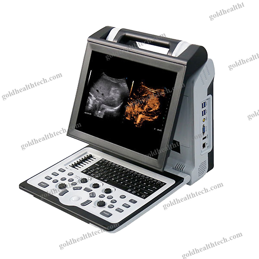 Portable Ultrasound System