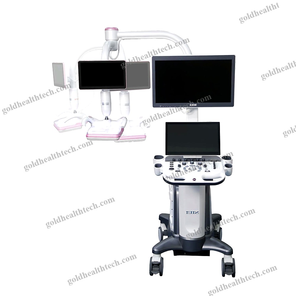 On-Platform Ultrasound System