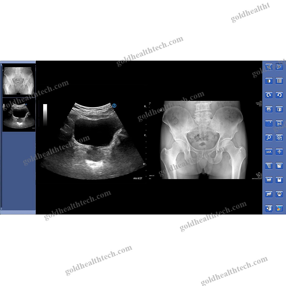 Portable Radiography System