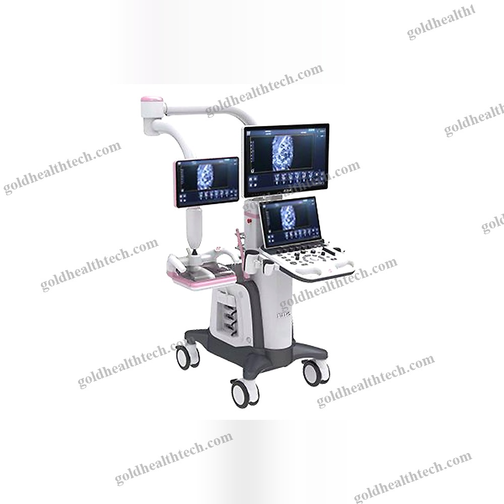 On-Platform Ultrasound System