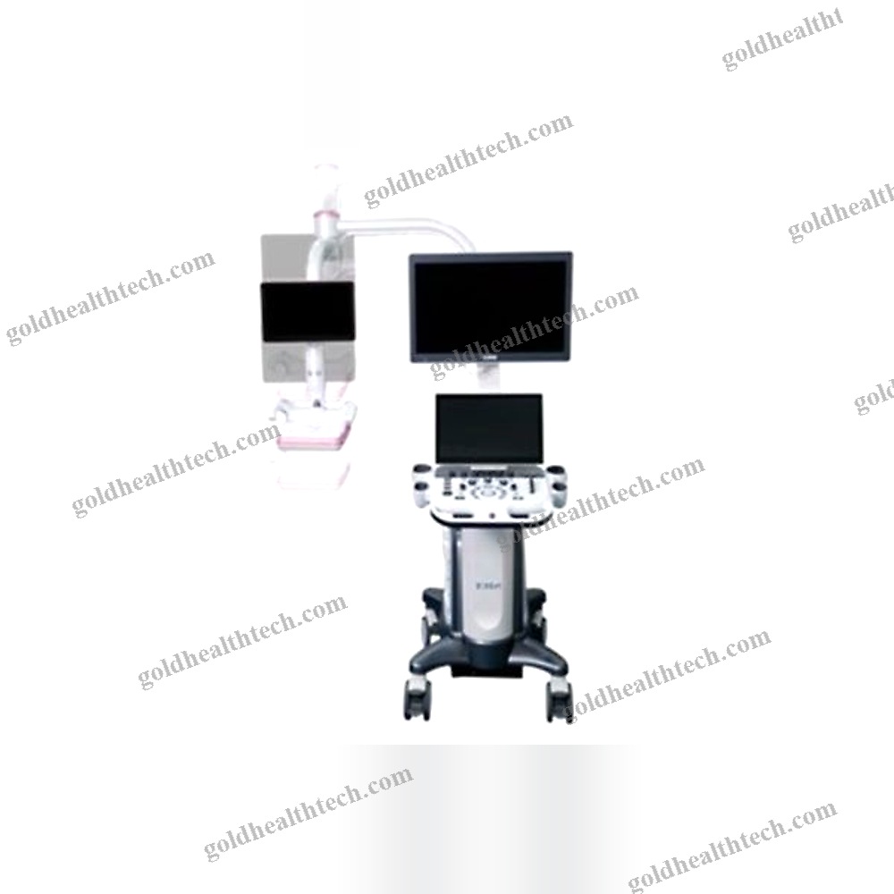 On-Platform Ultrasound System