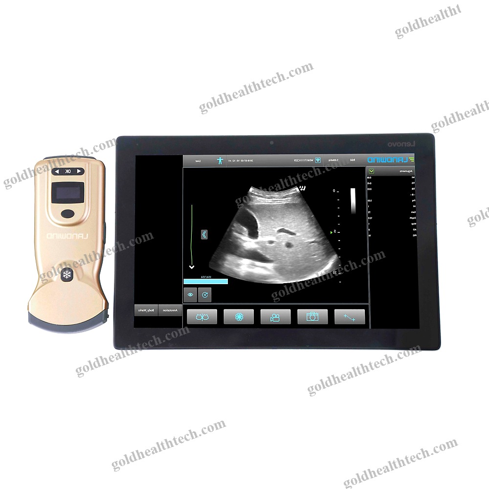 Hand-Held Ultrasound System