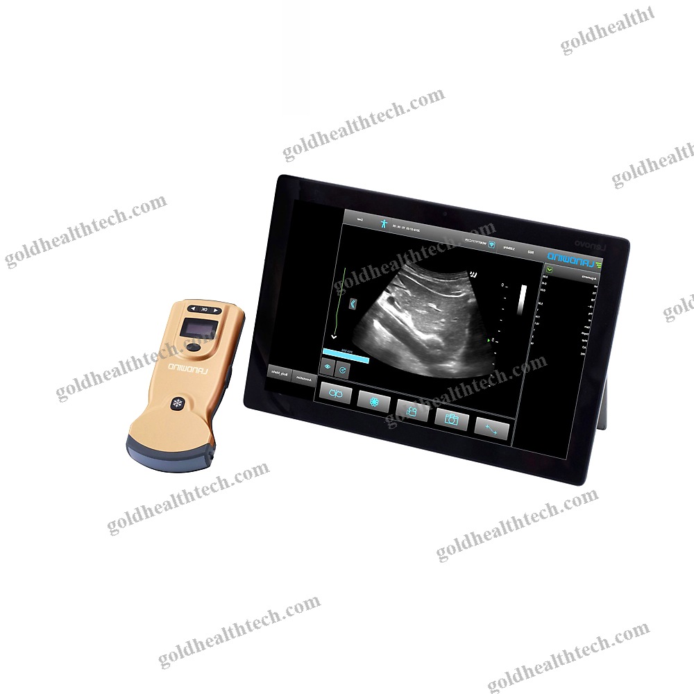 Hand-Held Ultrasound System