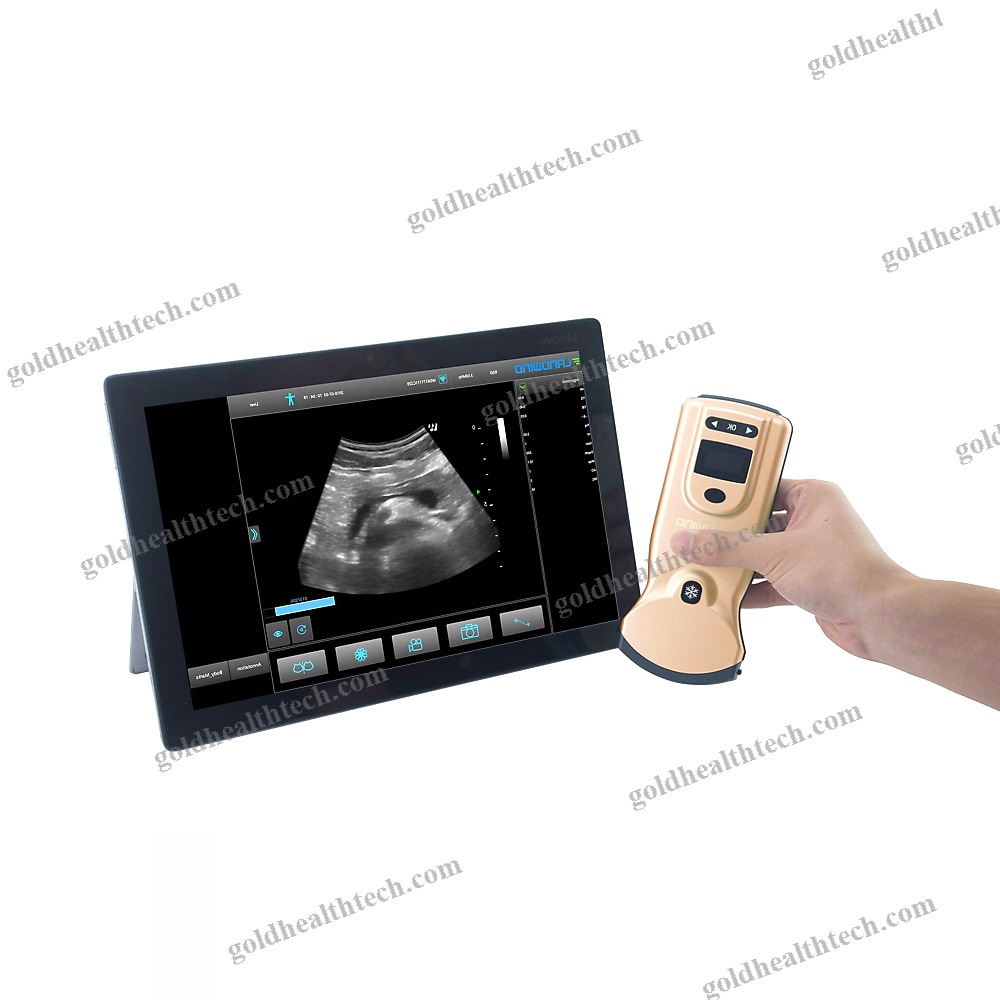 Hand-Held Ultrasound System