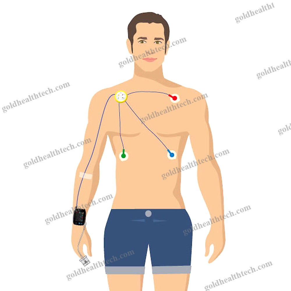 Continuous Patient Monitor
