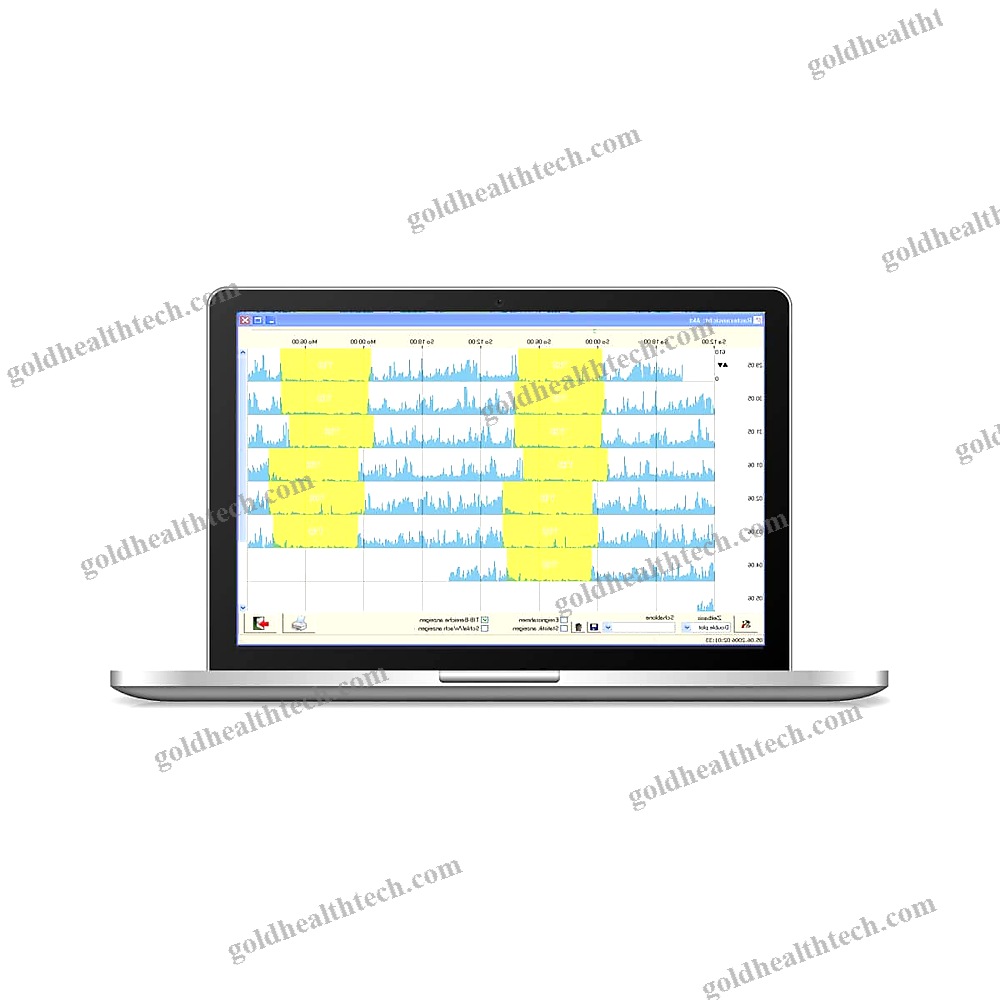 Wearable Activity Monitor