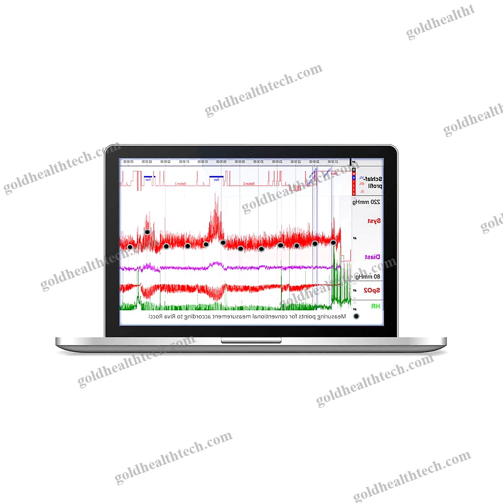 Continuous Patient Monitor