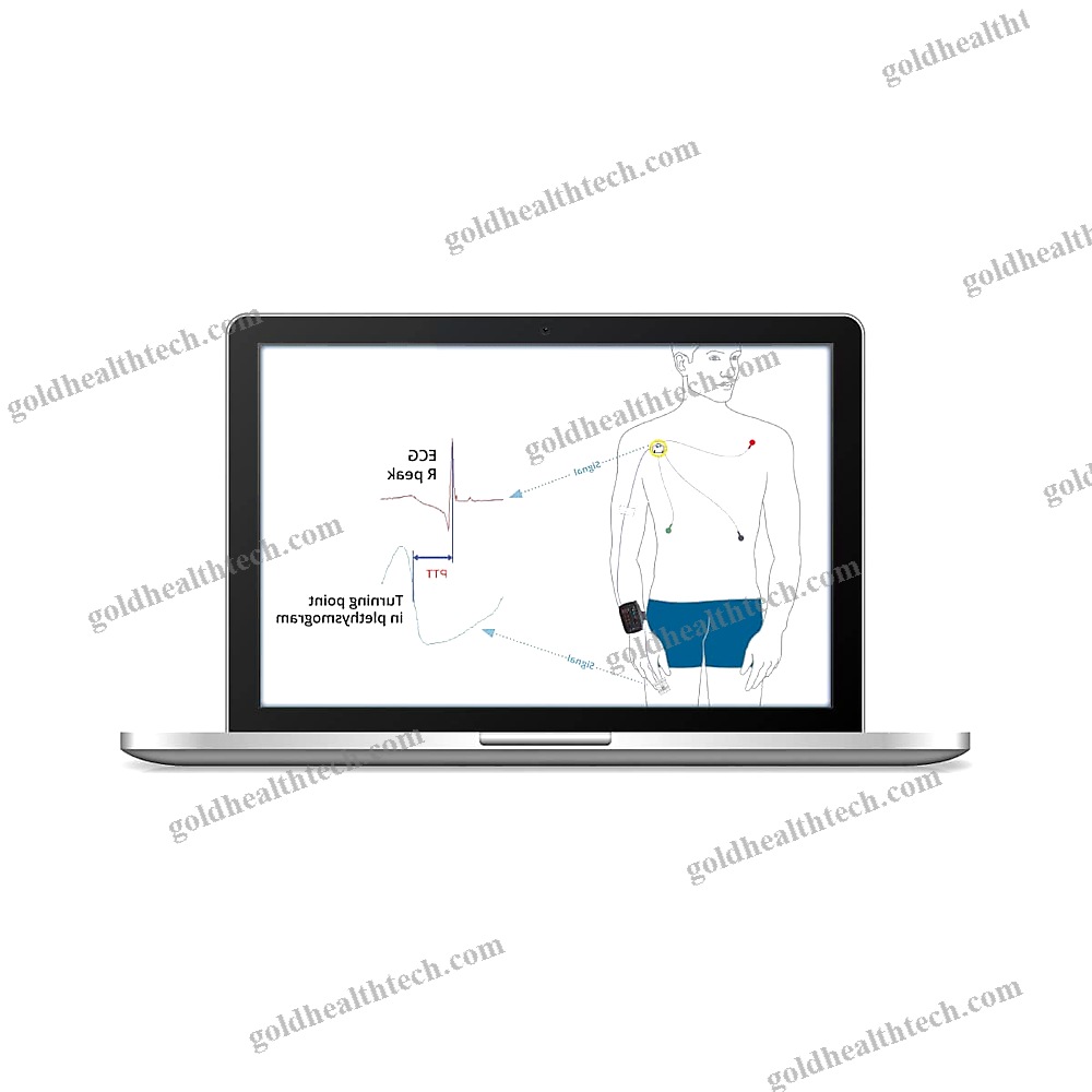 Continuous Patient Monitor