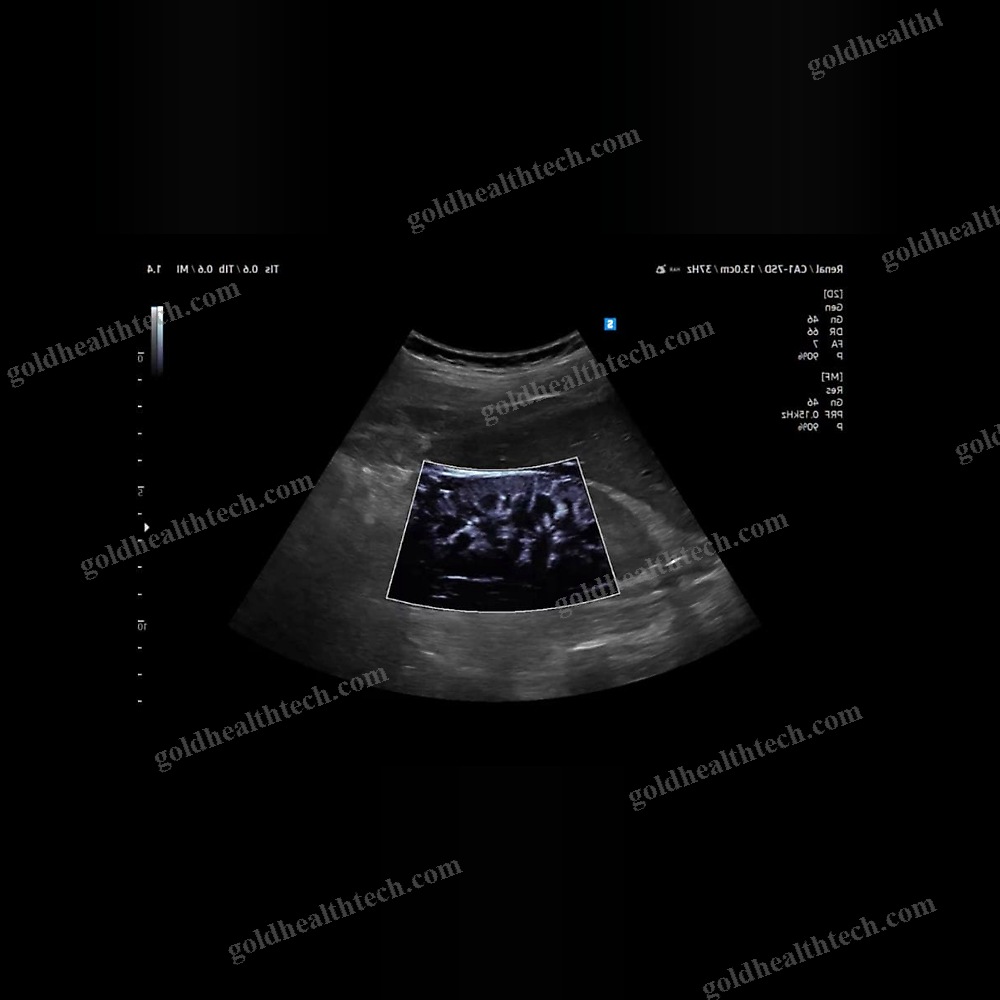On-Platform Ultrasound System