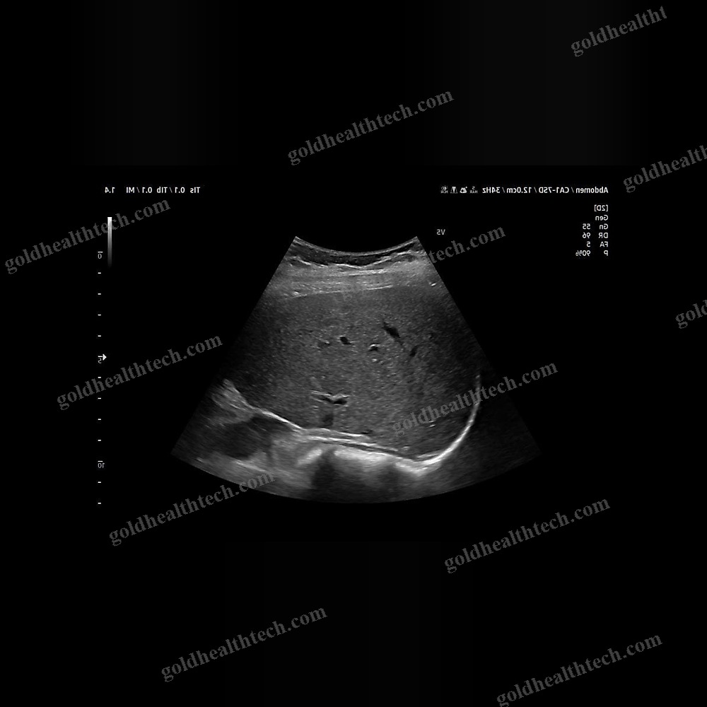 On-Platform Ultrasound System