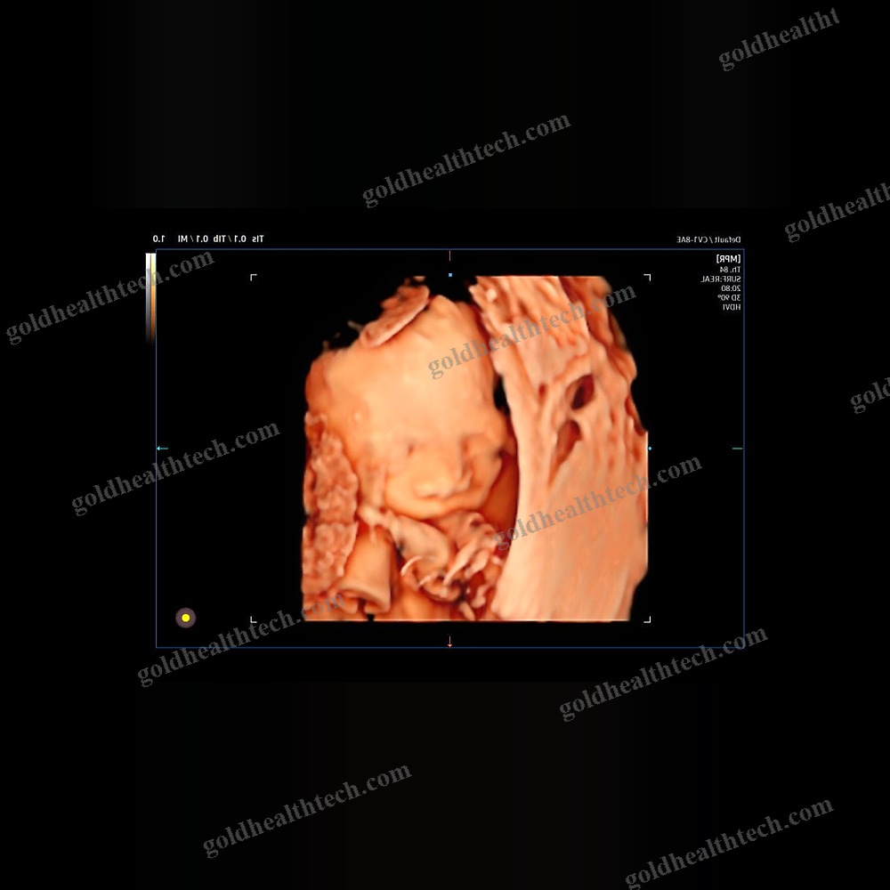 On-Platform Ultrasound System