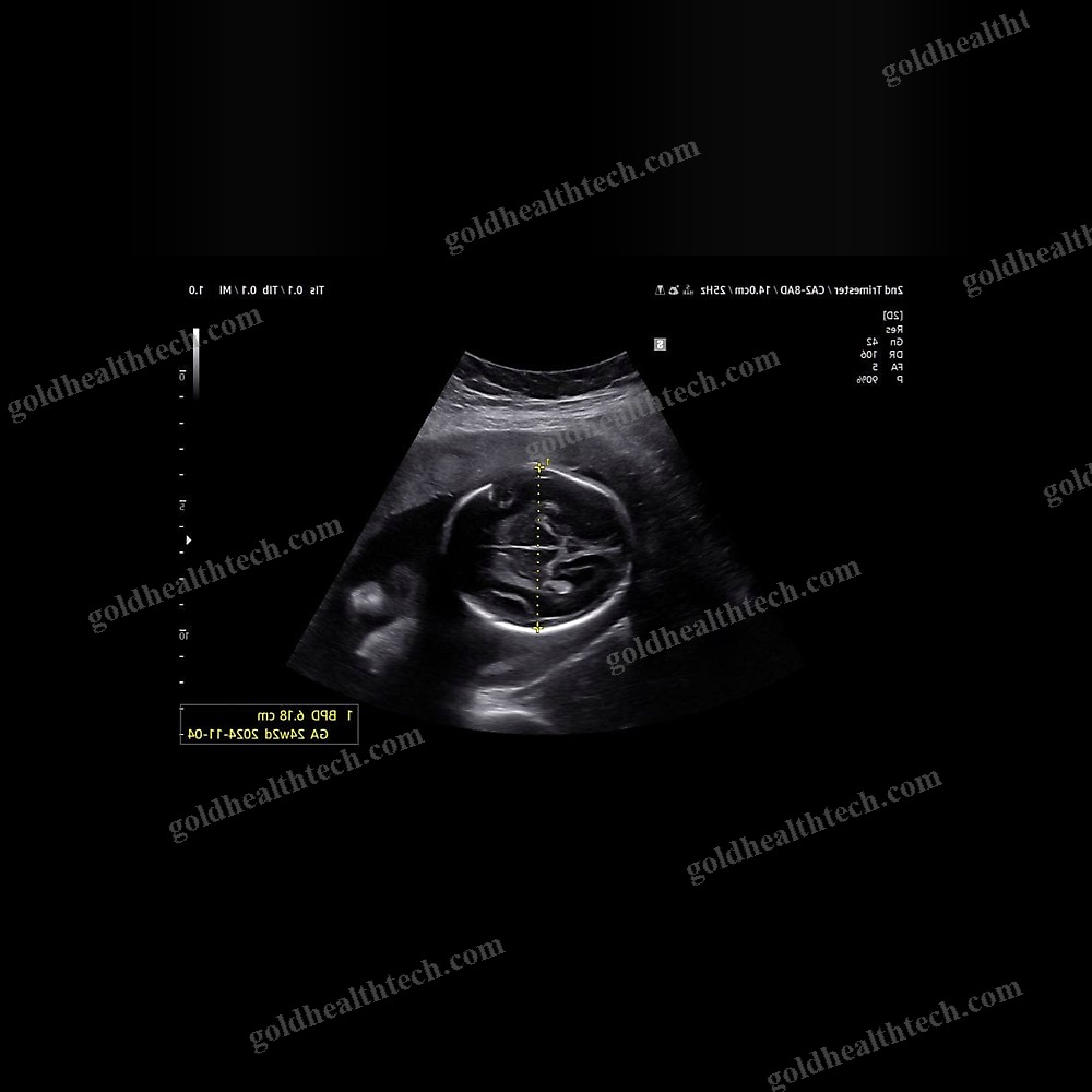 On-Platform Ultrasound System