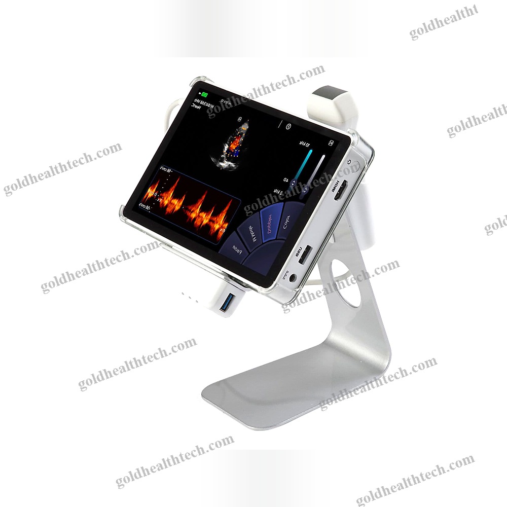 Hand-Held Ultrasound System