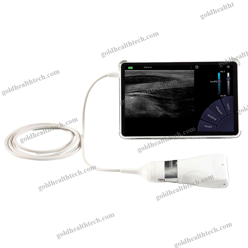 Hand-Held Ultrasound System