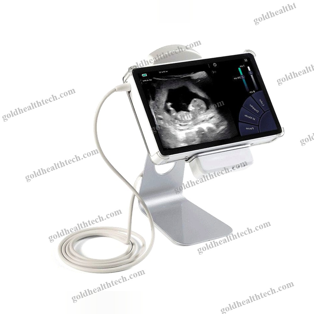 Hand-Held Ultrasound System