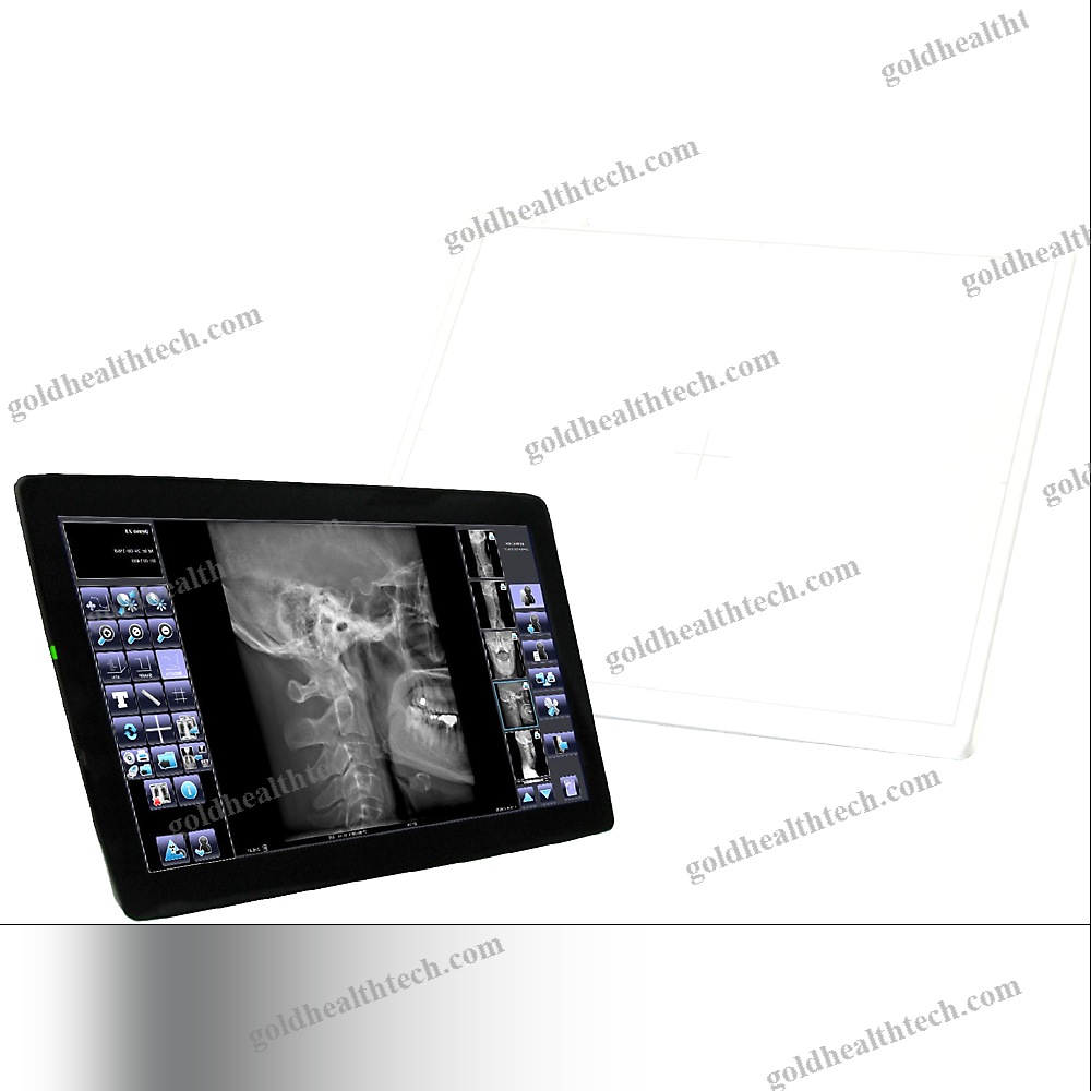 Radiography Acquisition System