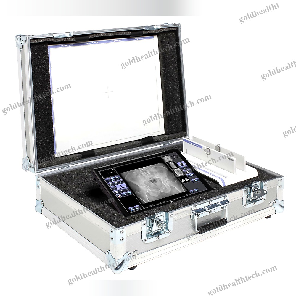 Radiography Acquisition System