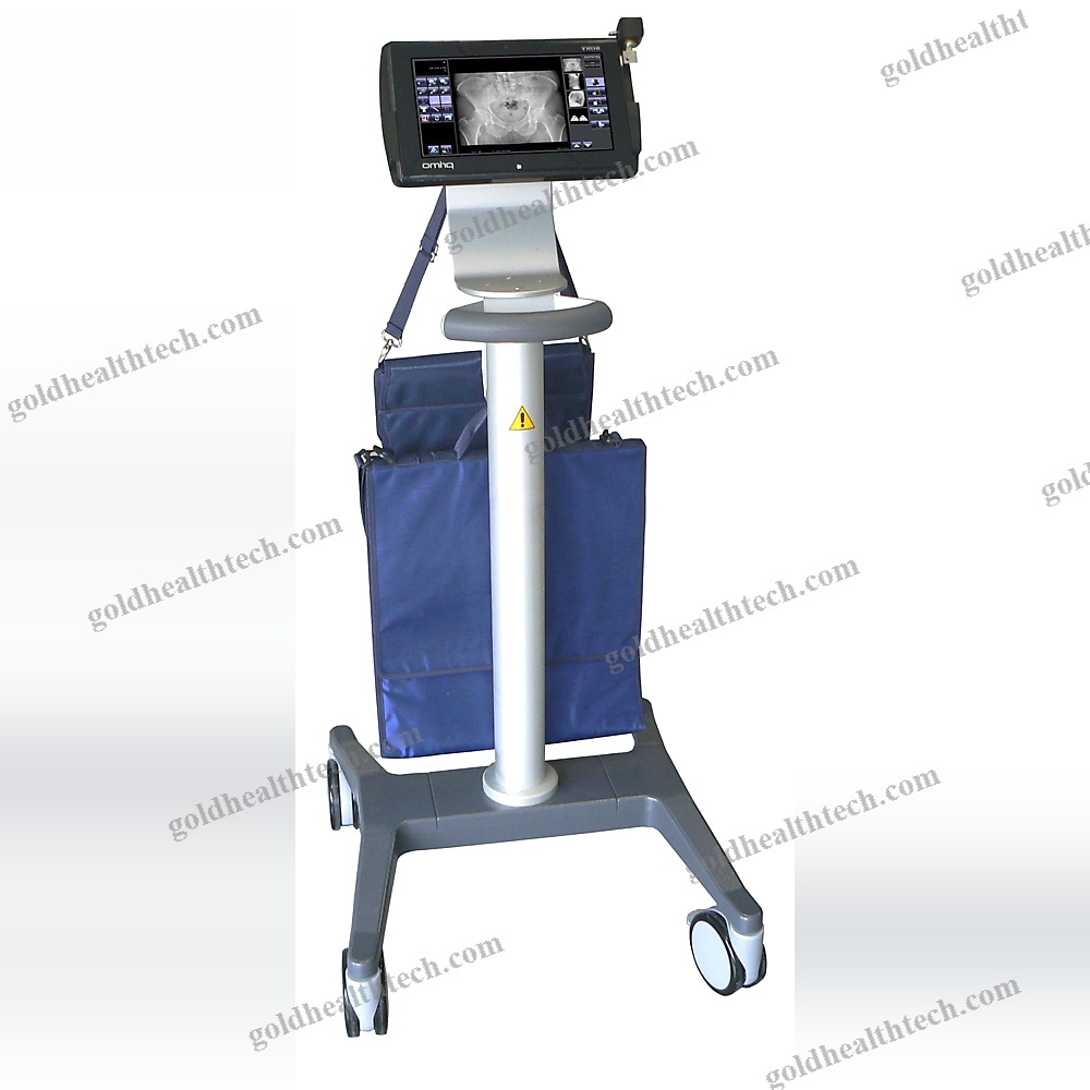 Radiography Acquisition System