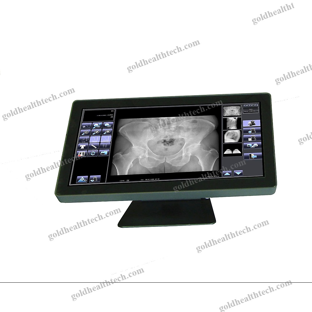 Radiography Acquisition System