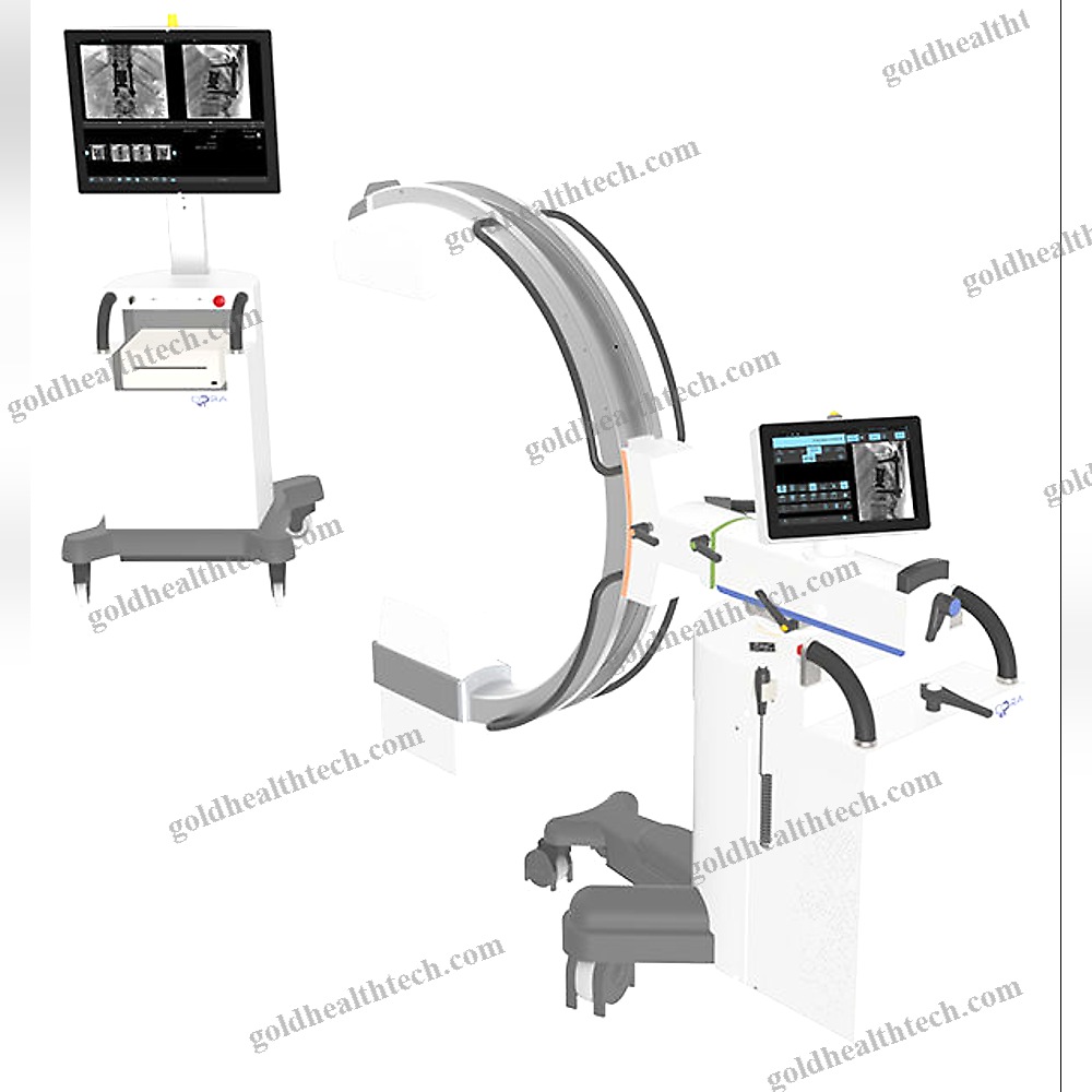 Mobile C-Arm